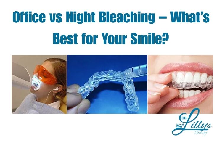 ast or Gentle Whitening? The Choice is Yours!