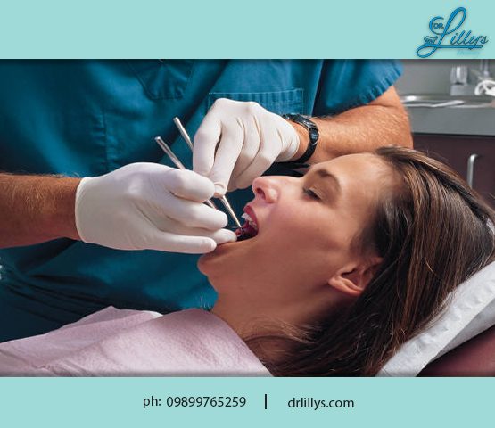 Cosmetic Dental Clinic in Delhi
